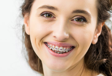 Zahnpflege für Spangenträger